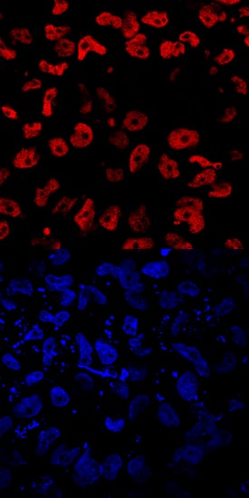 EOMES antibody in Mesodermally Differentiated BG01V Human Stem Cells by Immunocytochemistry (ICC).