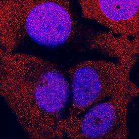 ERK1 antibody in MCF-7 Human Cell Line by Immunocytochemistry (ICC).