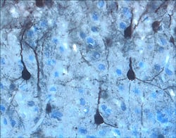 ERK1/ERK2 antibody in Rat Brain by Immunohistochemistry (IHC-Fr).