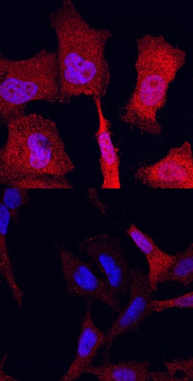 Phospho-ERK1 (T202/Y204)/ERK2 (T185/Y187) antibody in HeLa Human Cell Line by Immunocytochemistry (ICC).