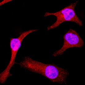 ERK5/BMK1 antibody in HeLa Human Cell Line by Immunocytochemistry (ICC).