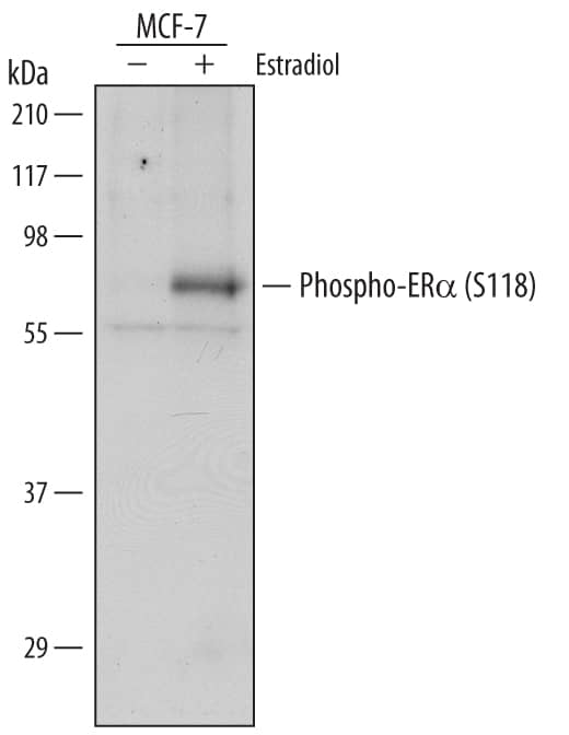 Detection of Human Phospho-ERa/NR3A1 (S118) antibody by Western Blot.