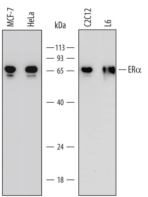 Detection of Human, Mouse, and Rat ERa/NR3A1 antibody by Western Blot.