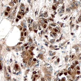 ERa/NR3A1 antibody in Human Breast by Immunohistochemistry (IHC-P).