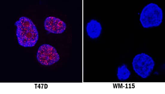 ERa/NR3A1 antibody in T47D and WM-115 Human Cell Lines by Immunocytochemistry (ICC).