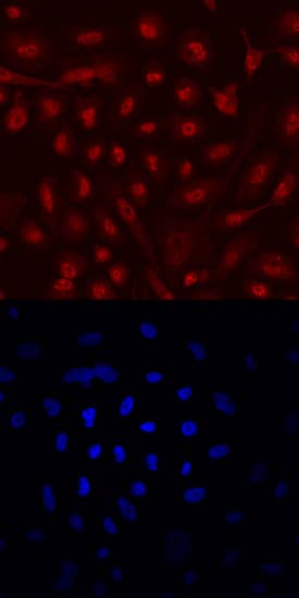 ERa/NR3A1 antibody in PC-3 Human Cell Line by Immunocytochemistry (ICC).