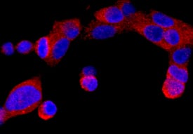 ER beta/NR3A2 antibody in LNCaP Human Cell Line by Immunocytochemistry (ICC).