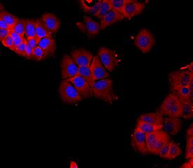 ER beta/NR3A2 antibody in MCF-7 Human Cell Line by Immunocytochemistry (ICC).
