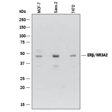 Detection of Human ER beta/NR3A2 antibody by Western Blot.