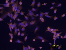 ESAM antibody in HUVEC Human Cells by Immunocytochemistry (ICC).