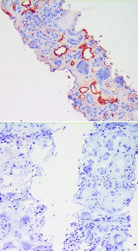 E-Selectin/CD62E antibody in LPS treated Human Kidney Tissue.