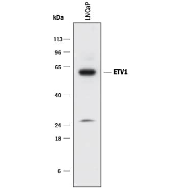 Detection of Human ETV1 antibody by Western Blot.