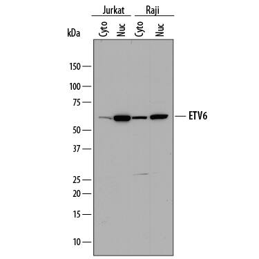 Detection of Human ETV6 antibody by Western Blot.