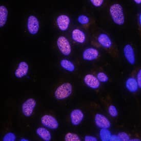 EVI-1 antibody in SK-OV-3 Human Cell Line by Immunocytochemistry (ICC).