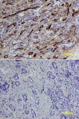 Endoglin/CD105 antibody in Human Prostate by Immunohistochemistry (IHC-P).