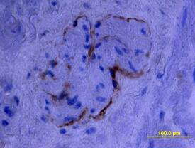 Endoglin/CD105 antibody in Human Prostate by Immunohistochemistry (IHC-P).