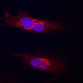 Endoglycan/PODXL2 antibody in Human HUVEC by Immunocytochemistry (ICC).