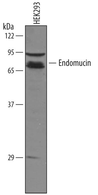 Detection of Human Endomucin antibody by Western Blot.