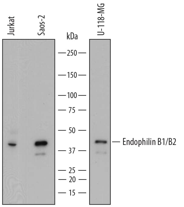 Detection of Human Endophilin B1/B2 antibody by Western Blot.