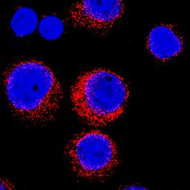 Endophilin B1/B2 antibody in Jurkat Human Cell Line by Immunocytochemistry (ICC).
