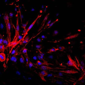 Endosialin/CD248 antibody in bEnd by Immunocytochemistry (ICC).3 Mouse Cell Line by Immunocytochemistry (ICC).