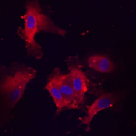 Endothelin-1 antibody in HUVEC Human Cells by Immunocytochemistry (ICC).