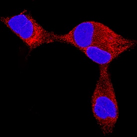 Endothelin-3 antibody in LNCaP Human Cell Line by Immunocytochemistry (ICC).