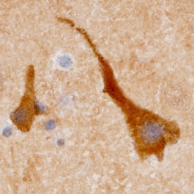 Enolase 2 antibody in Human Brain by Immunohistochemistry (IHC-P).