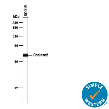 Detection of Human Enolase 2/Neuron-specific Enolase antibody by Simple WesternTM.
