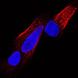 Enolase 2/Neuron-specific Enolase antibody in SH-SY5Y Human Cell Line by Immunocytochemistry (ICC).