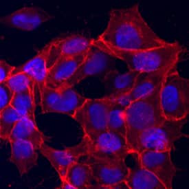 EpCAM/TROP-1 antibody in BG01V Human Embryonic Stem Cells by Immunocytochemistry (ICC).