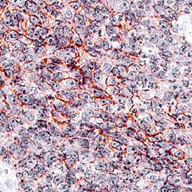 EpCAM/TROP-1 antibody in Human Colon by Immunohistochemistry (IHC-P).