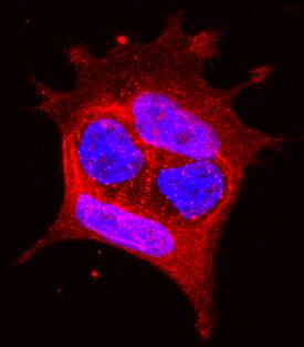 EphA1 antibody in MCF-7 Human Cell Line by Immunocytochemistry (ICC).