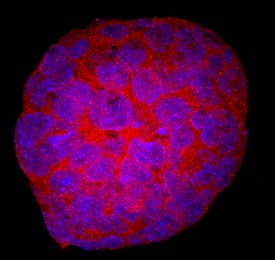 EphA1 antibody in D3 Mouse Cell Line by Immunocytochemistry (ICC).