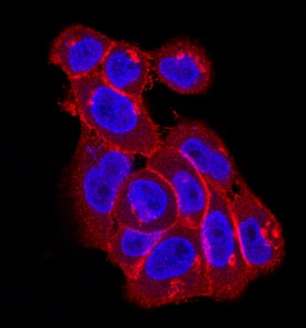 EphA2 antibody in A431 Human Cell Line by Immunocytochemistry (ICC).