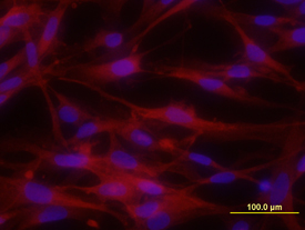 EphA5 antibody in U-118-MG Human Cell Line by Immunocytochemistry (ICC).