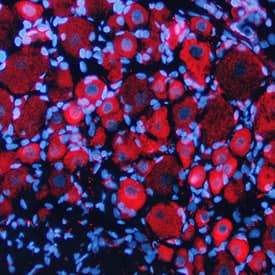 EphB1 antibody in Rat Brain by Immunohistochemistry (IHC-Fr).