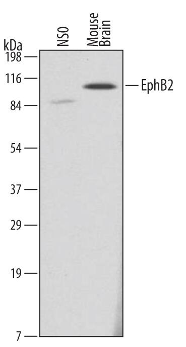 Detection of Mouse EphB2 antibody by Western Blot.