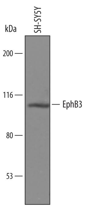 Detection of Human EphB3 antibody by Western Blot.