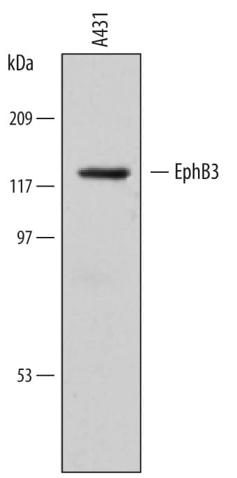 Detection of Human EphB3 antibody by Western Blot.