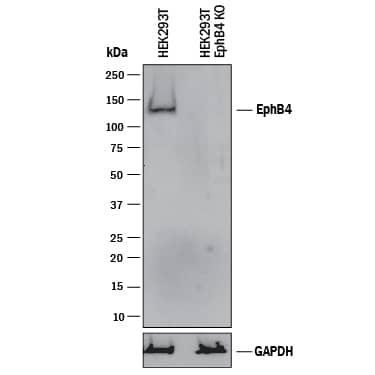 Western Blot Shows Human EphB4 Antibody Specificity by Using Knockout Cell Line.