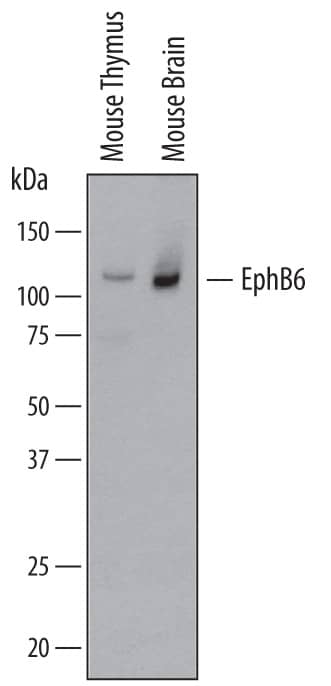 Detection of Mouse EphB6 antibody by Western Blot.