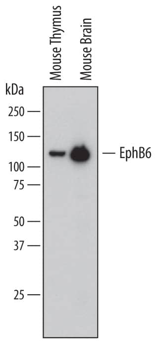 Detection of Mouse EphB6 antibody by Western Blot.