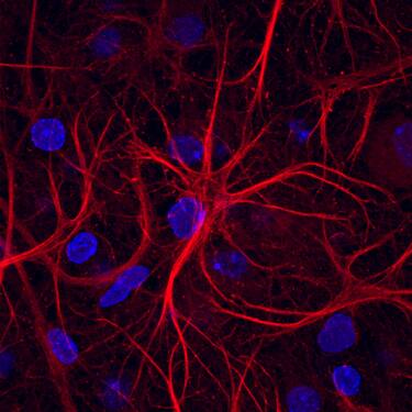 Ephrin-B2 antibody in Rat Hippocampal Neurons by Immunocytochemistry (ICC).