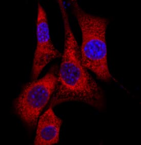 Eps15 antibody in NIH-3T3 Mouse Cell Line by Immunocytochemistry (ICC).