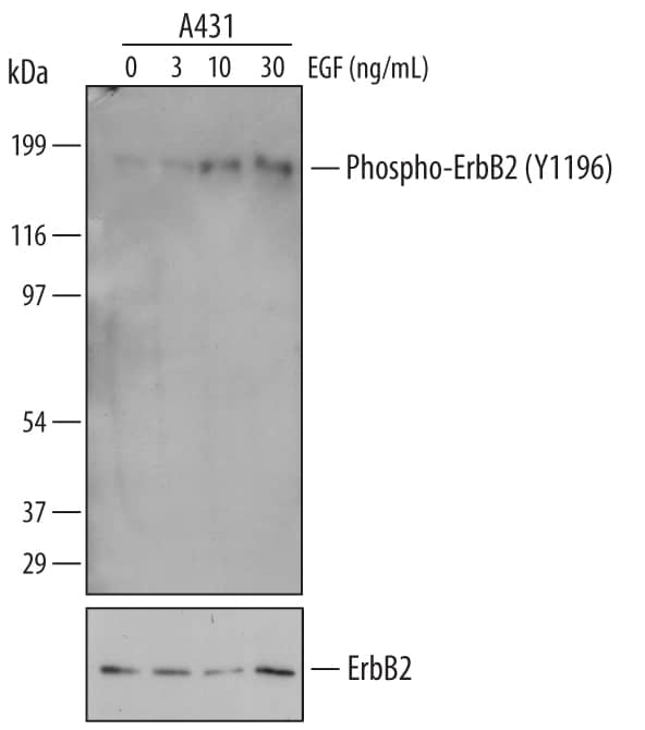 Detection of Human Phospho-ErbB2/Her2 (Y1196) antibody by Western Blot.