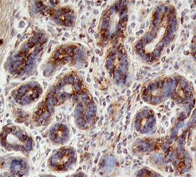 ErbB2/Her2 antibody in Human Breast by Immunohistochemistry (IHC-P).