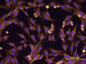 ErbB2/Her2 antibody in MDA-MB-231 Human Cell Line by Immunocytochemistry (ICC).