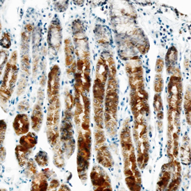 ErbB2/Her2 antibody in Human Stomach by Immunohistochemistry (IHC-P).