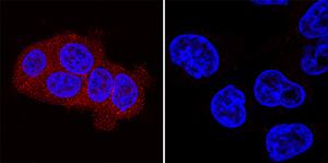 ErbB3/Her3 antibody in MCF-7 and MDA-MD-231 Human Cell Lines by Immunocytochemistry (ICC).